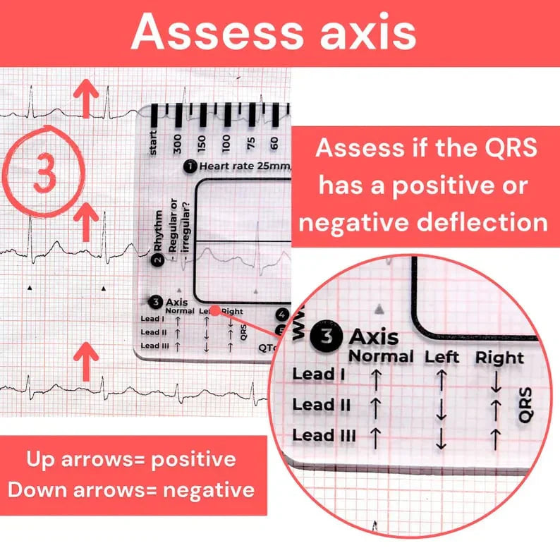 CardioScale™ - Règle ECG à 7 niveaux