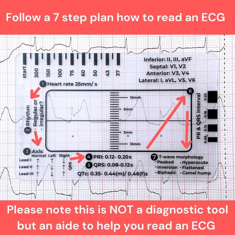 CardioScale™ - Règle ECG à 7 niveaux