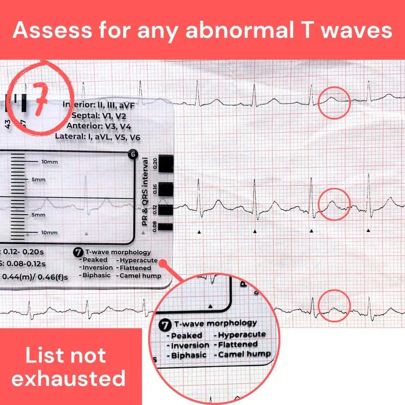 CardioScale™ - Règle ECG à 7 niveaux