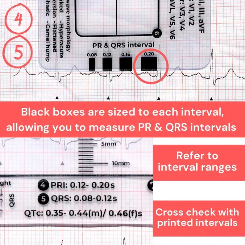 CardioScale™ - Règle ECG à 7 niveaux
